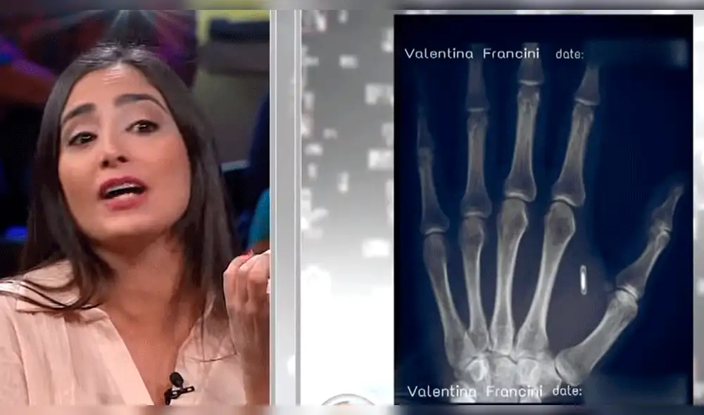 Ana María Polo furiosa con litigante por poner raro objeto en el cuerpo de su hija 