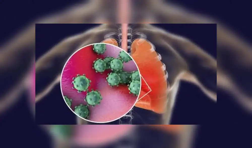 Cuando el coronavirus infecta los alvéolos de los pulmones es donde se intensifica las consecuencias mortales. Foto: BBC. Cuando el coronavirus infecta los alvéolos de los pulmones es donde se intensifica las consecuencias mortales. Foto: BBC.
