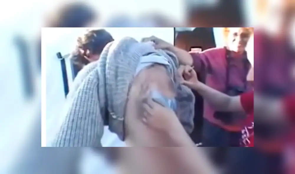 Facebook viral: misteriosas criaturas vivían dentro de la espalda de un joven sin que él lo sepa [VIDEO]