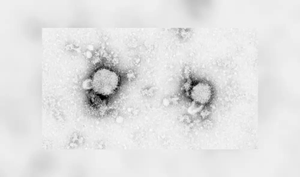 El Arenavirus ha cobrado la vida de tres personas desde mayo. Foto: Wikipedia.