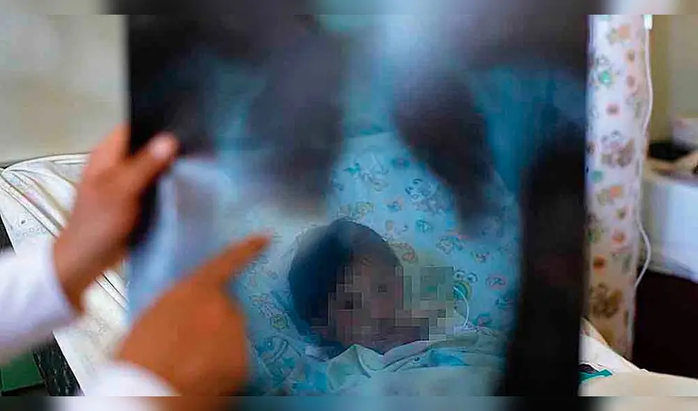 CUIDADO. Reporte de Salud precisa que tasa de número de neumonías y de muertes en ancianos creció en casi el 10% este año.