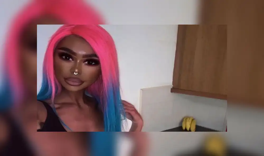 Joven se inyecta fármaco tres veces por semana para oscurecer su piel  [FOTOS]