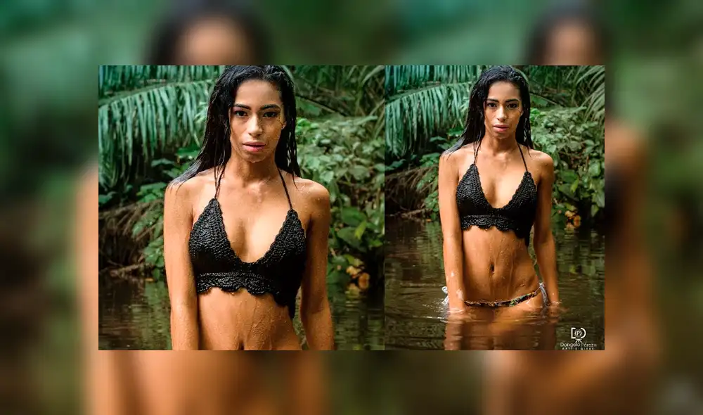 Candidata panameña asegura que fue expulsada de un concurso de belleza por vitiligo [VIDEO]