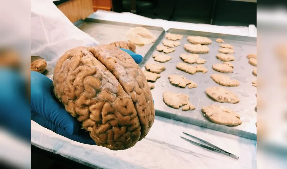 En Harvard existe un banco que almacena más de cinco mil cerebros.