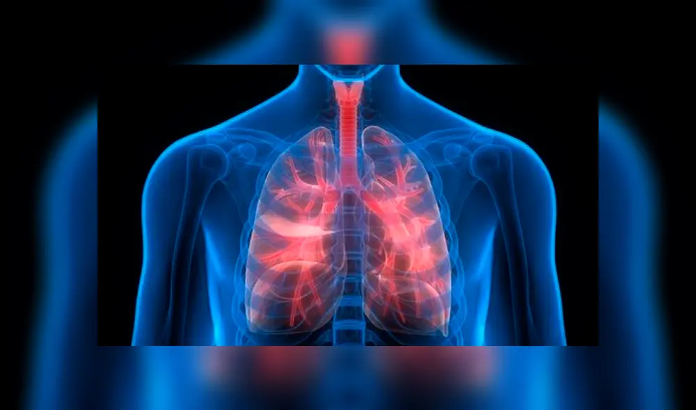 Fibrosis pulmonar: ¿Qué le sucede al órgano cuando se presenta la enfermedad?