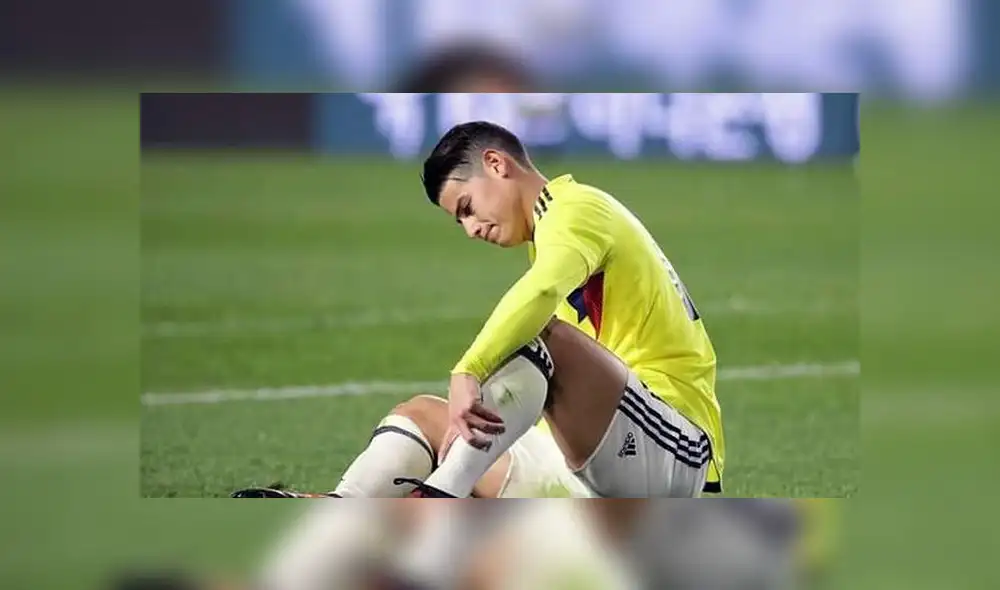 James Rodríguez: Parte médico confirma gravedad de su lesión y no jugaría hasta el 2020 James Rodríguez: Parte médico confirma gravedad de su lesión y no jugaría hasta el 2020