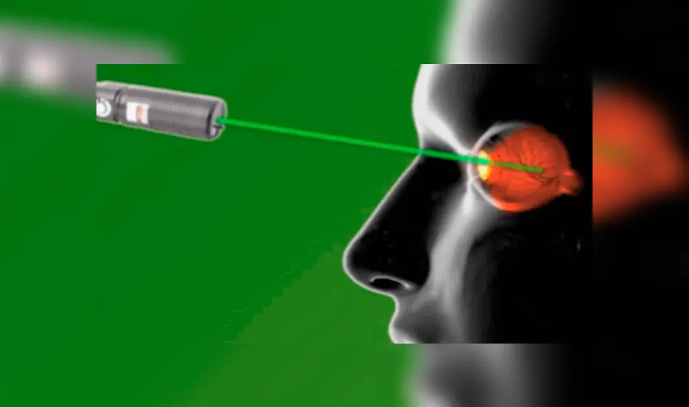 Niño sufre daños irreparables en los ojos tras mirar fijamente a un puntero láser