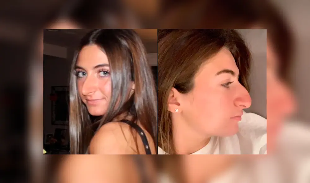 La joven mostró el antes y el después de su operación en la nariz y ahora luce totalmente diferente. Foto: captura La joven mostró el antes y el después de su operación en la nariz y ahora luce totalmente diferente. Foto: captura
