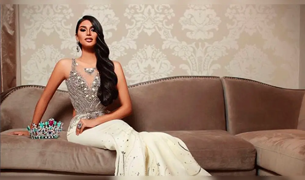 Filtran inéditas imágenes de Miss Venezuela antes de operaciones en el rostro