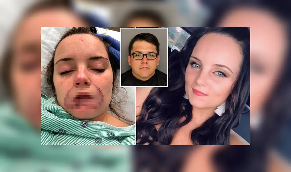 Desfiguró rostro de expareja porque ella se negó a darle un beso