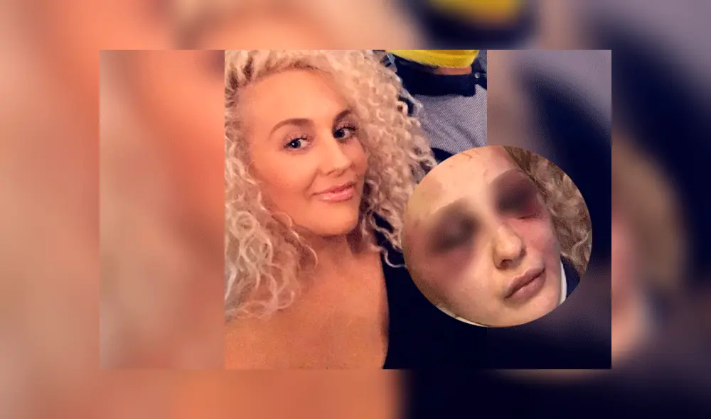 La víctima estuvo cuatro semanas en coma. La víctima estuvo cuatro semanas en coma.