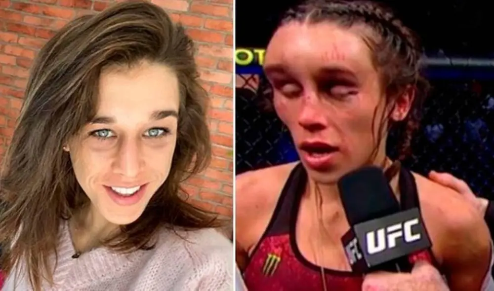 Así luce el rostro recuperado de Joanna Jedrzejczyk. Foto: Instagram