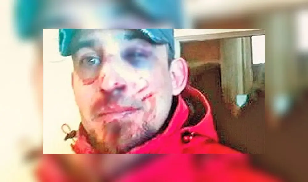 La víctima teme perder su ojo. (Fuente: Crónica) La víctima teme perder su ojo. (Fuente: Crónica)