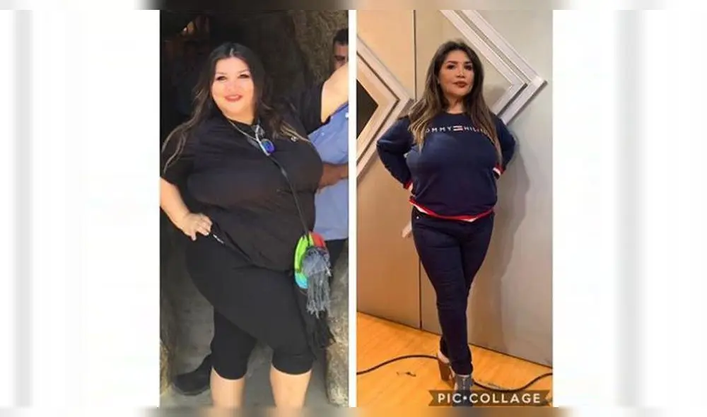 Antes y después de la abogada y vedette Lucy Cabrera  tras perder peso con la banda gástrica. Fuente: Instagram