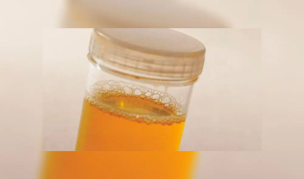 Muestra de orina Muestra de orina