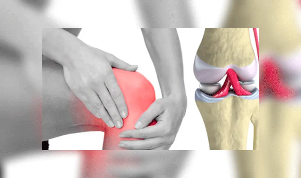 Osteosarcoma: el cáncer de huesos más común durante la infancia Osteosarcoma: el cáncer de huesos más común durante la infancia