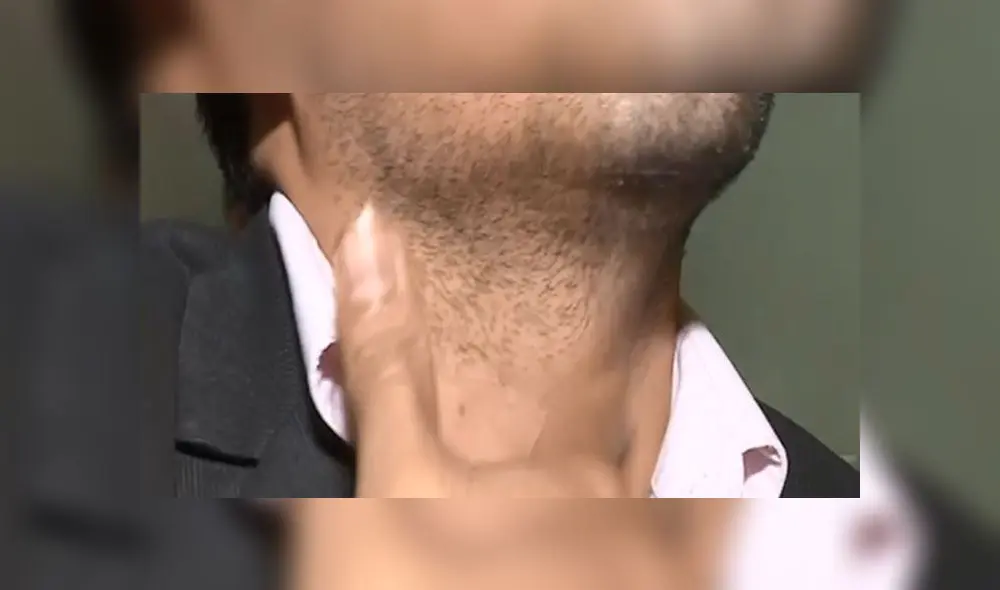 Uno de los hijos del hombre explicó los problemas de salud que atraviesa su padre. (Foto: Captura video / Latina)