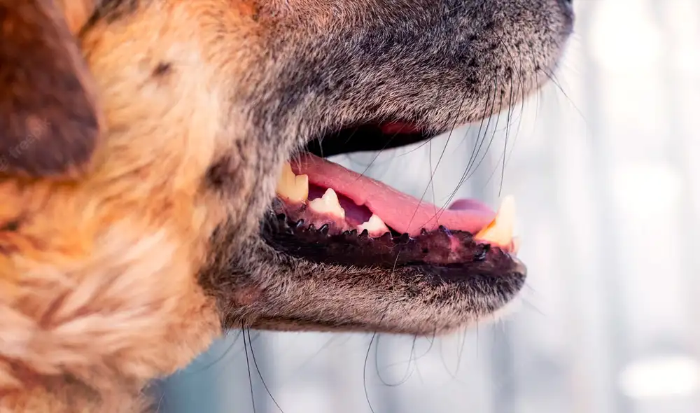 El médico contó que era probable que la paciente sea sometida a una doble amputación de sus extremidades. Foto: Freepik El médico contó que era probable que la paciente sea sometida a una doble amputación de sus extremidades. Foto: Freepik