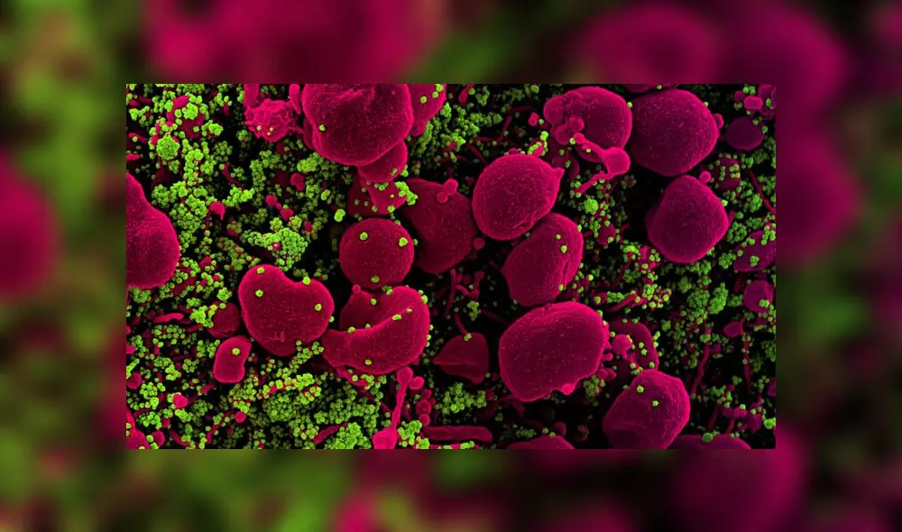 Imagen microscopica del SARS-CoV-2. Foto: NIAID Imagen microscopica del SARS-CoV-2. Foto: NIAID