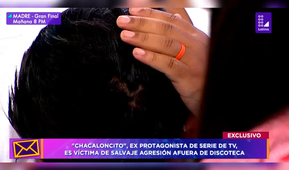 'Chacaloncito' reapareció para denunciar intento de asesinato por ciudadanos extranjeros