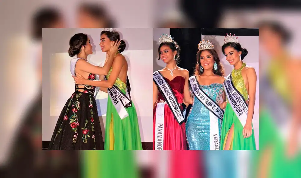 Candidata panameña asegura que fue expulsada de un concurso de belleza por vitiligo [VIDEO]