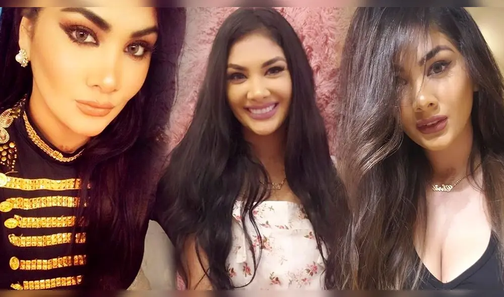 Chris Soifer muestra su nueva figura tras ingresar al quirófano. Foto: Archivo