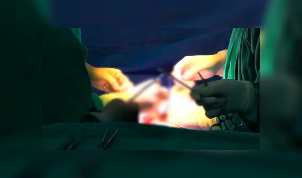 Luego de la intervención, el pequeño logró salir airoso. Foto: EsSalud Luego de la intervención, el pequeño logró salir airoso. Foto: EsSalud