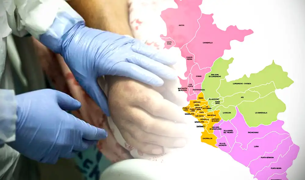 Estos son los distritos de Lima con más casos de viruela del mono. Foto: EFE/MapadeLima.com/Composición LR Estos son los distritos de Lima con más casos de viruela del mono. Foto: EFE/MapadeLima.com/Composición LR