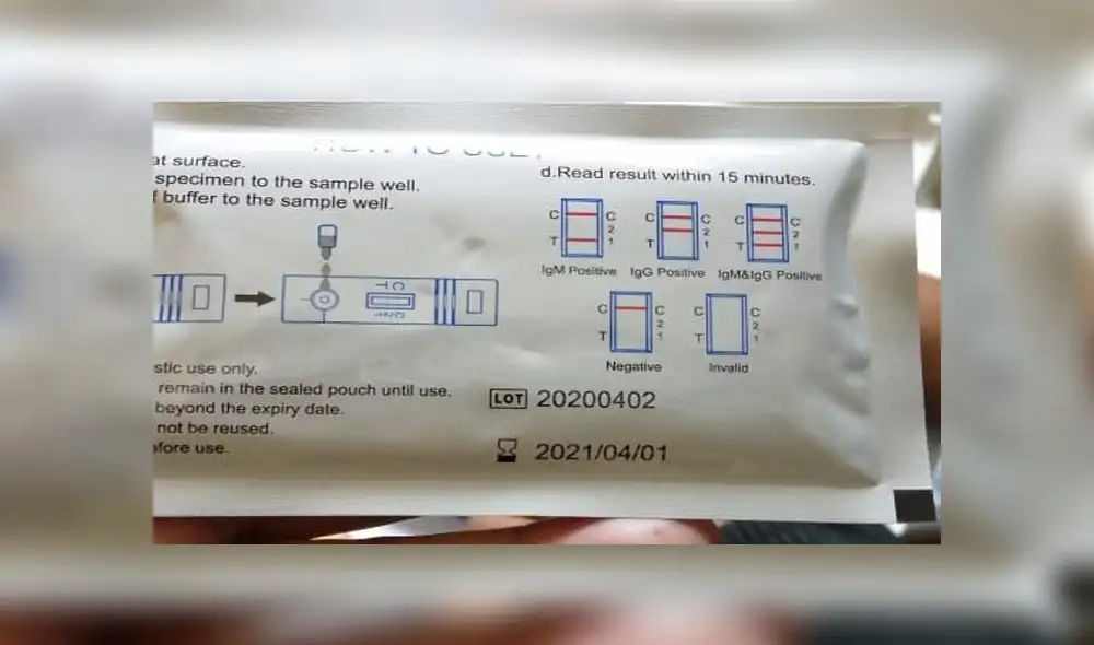 Foto: Óscar Chumpitaz.