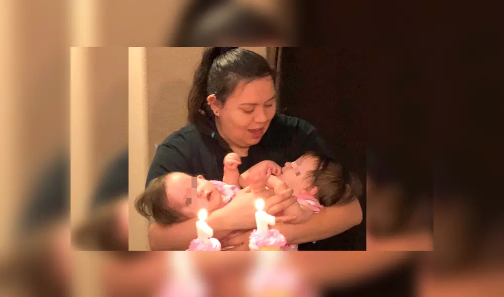 Mamá de siamesas se niega a separarlas pese a que los médicos le pidieron abortarlas
