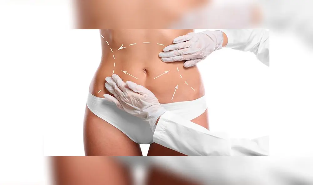 Smart Lipo: Una alternativa diferente para este verano