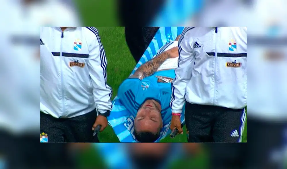 Sporting Cristal:  Emanuel Herrera quedaría fuera de la Liga 1 por esta lesión