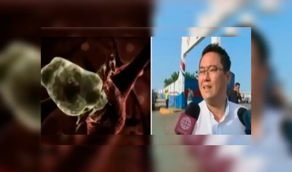 Piscina donde niña se habría contagiado con la ameba ‘come cerebros’ no era apta