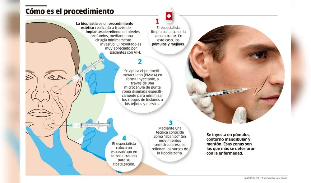 La esperanza en el rostro La esperanza en el rostro