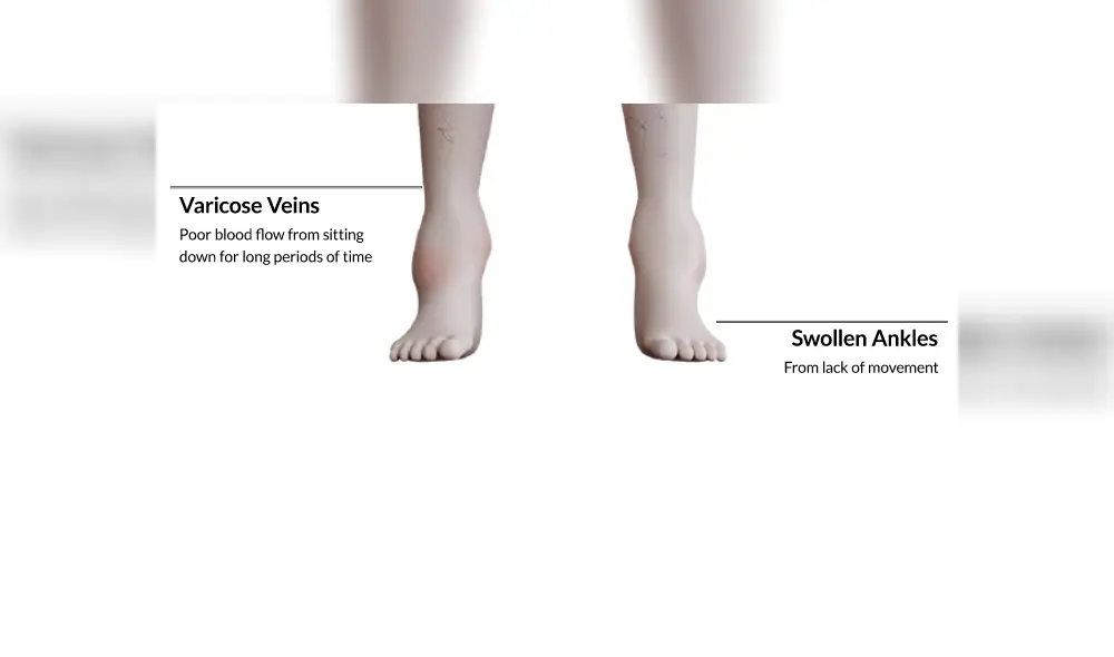 Muchos gamers mantienen hábitos que podrían impactar fuertemente en su salud y aspecto físico.