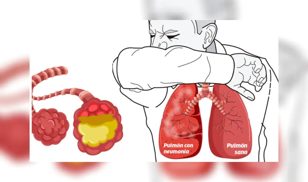COVID-19: ¿Cuánto tiempo sobrevive el virus en el aire y en la superficie de los objetos? COVID-19: ¿Cuánto tiempo sobrevive el virus en el aire y en la superficie de los objetos?