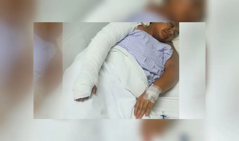 Madre de familia sufre por quemaduras ocasionadas en atentado en bus Madre de familia sufre por quemaduras ocasionadas en atentado en bus