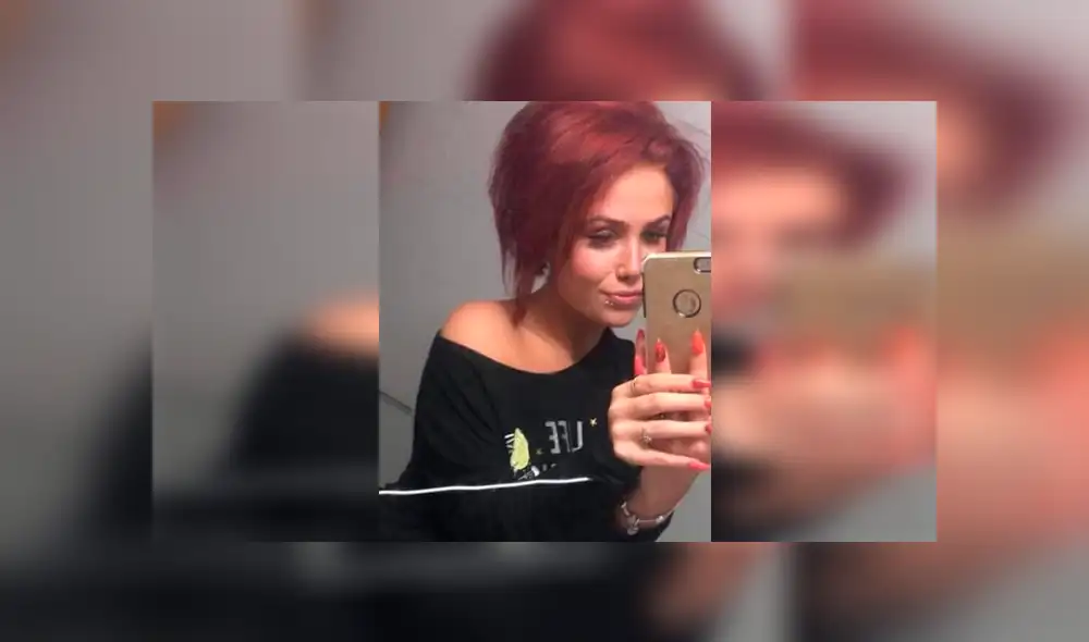 Mujer pagó 200 dólares para tener labios perfectos, pero cirujano se los dejó deformados [FOTOS]