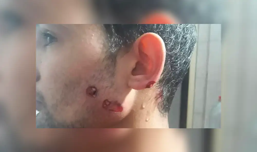 Sebastián Britos salió de su casa para comprar el pan y fue baleado en plena cuarentena por el coronavirus. (Foto: Infopico) Sebastián Britos salió de su casa para comprar el pan y fue baleado en plena cuarentena por el coronavirus. (Foto: Infopico)