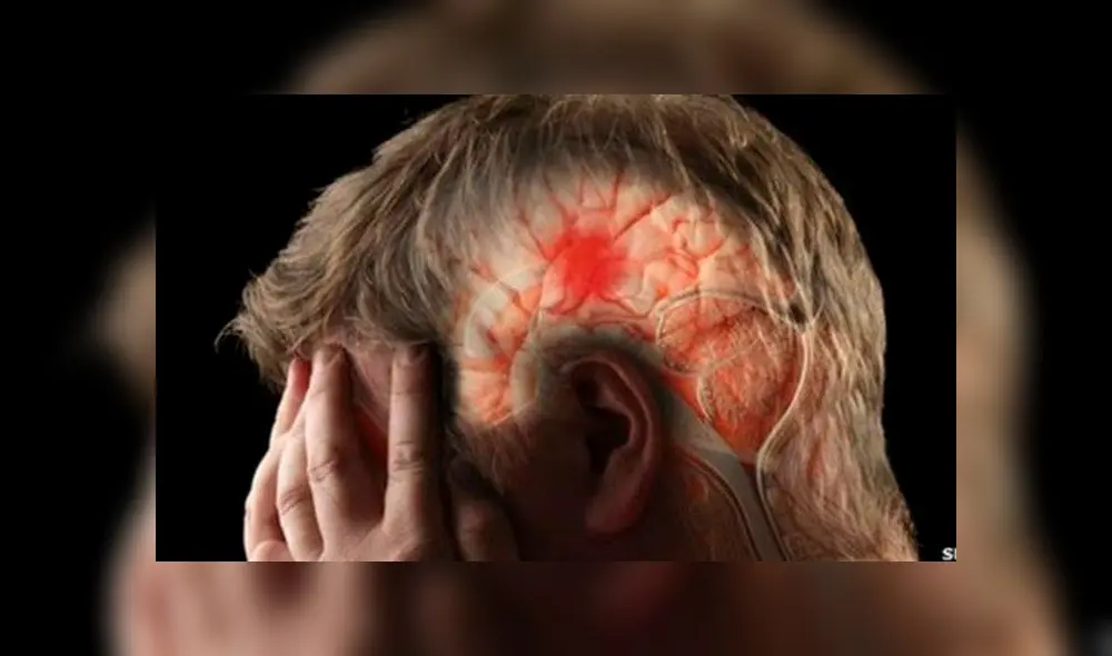 Los científicos encontraron relación entre las horas de sueño y la propensión a sufrir un derrame cerebral. Imagen: SPL. Los científicos encontraron relación entre las horas de sueño y la propensión a sufrir un derrame cerebral. Imagen: SPL.