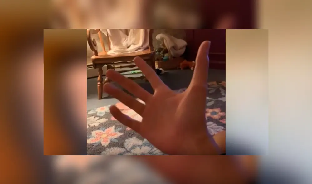 Su extraña condición ha causado sensación en Facebook, luego de difundir su peculiar malformación a través de unos videos