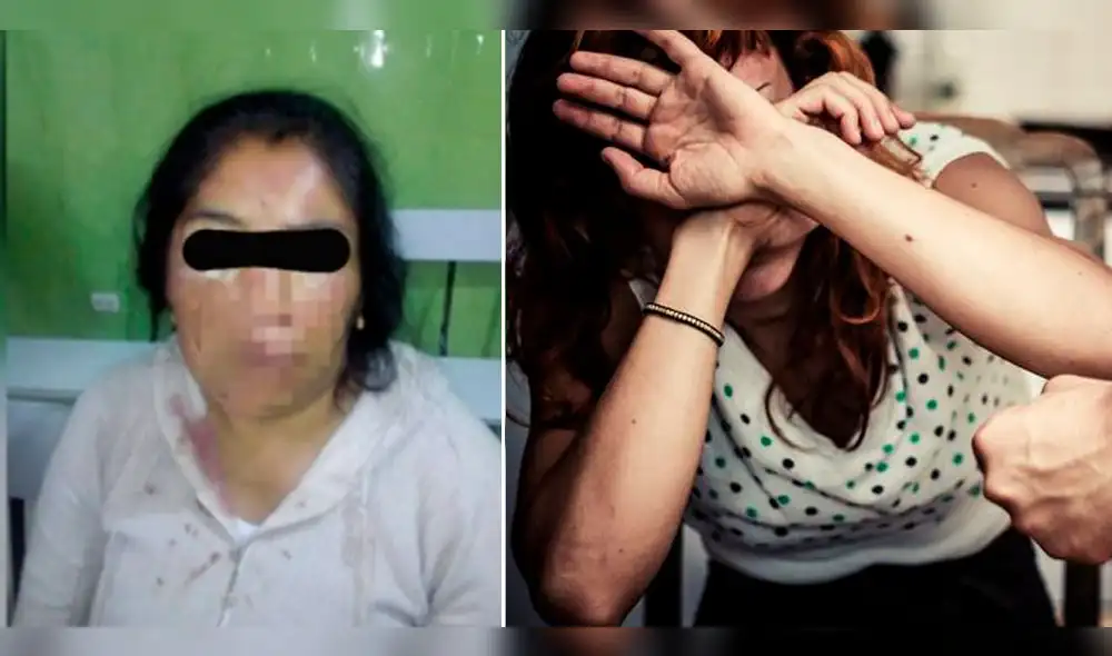 Tacna: Mujer es desfigurada y golpeada por su cuñado ebrio