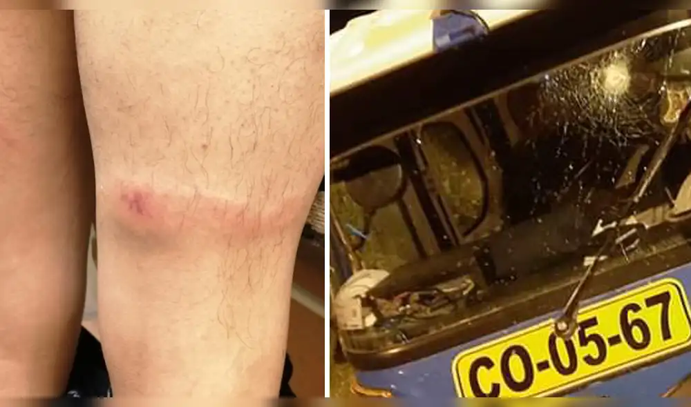 Ronderos golpean a enfermero. Ronderos golpean a enfermero.