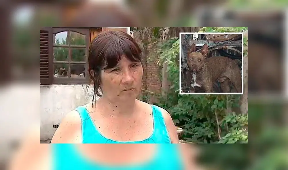 Niña de dos años sufre salvaje ataque de perro pitbull y recibe 40 puntos en su pierna [VIDEO]