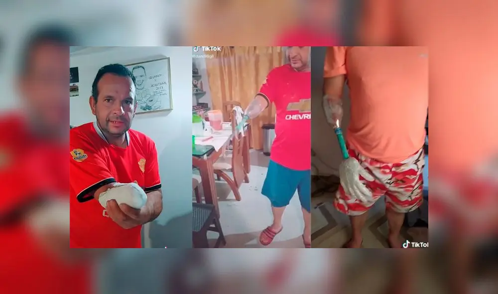 Desliza las imágenes para ver la increíble prótesis casera que construyó este hombre para su brazo amputado. Foto: dani98gil/TikTok