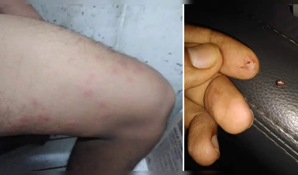 Chinches alertan a pasajeros de bus Lima-Chiclayo Chinches alertan a pasajeros de bus Lima-Chiclayo