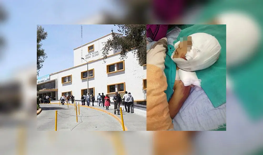 Menor se encuentra internado en el hospital Honorio Delgado Menor se encuentra internado en el hospital Honorio Delgado