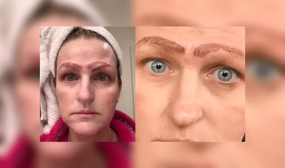 Facebook viral: así quedó una mujer que se sometió a un tratamiento de tatuaje de cejas [VIDEO]