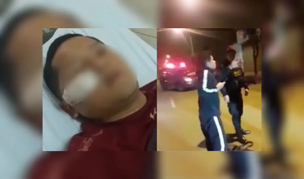 Jóvenes aseguran que policías no se identificaron antes de hacer los disparos. (Foto: Captura de video / América TV) Jóvenes aseguran que policías no se identificaron antes de hacer los disparos. (Foto: Captura de video / América TV)