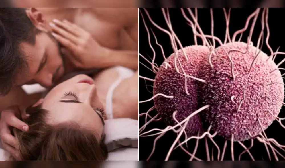 Salud: primer caso de 'Gonorrea superresistente' alarma a expertos Salud: primer caso de 'Gonorrea superresistente' alarma a expertos